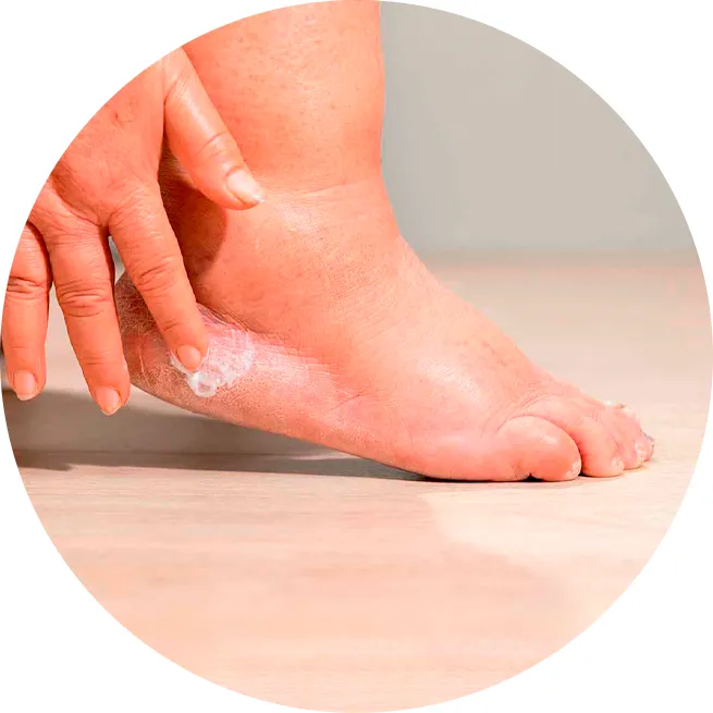 Bienestar para tus pies
